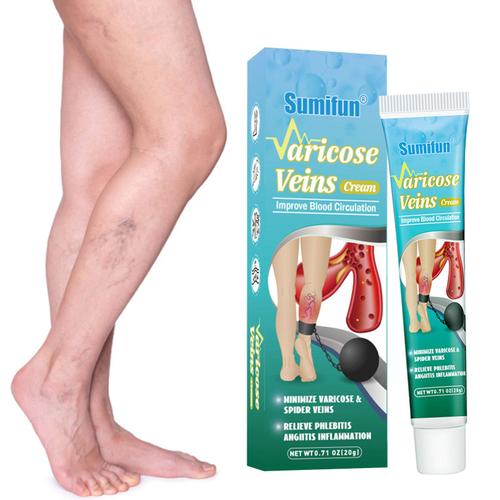 Plâtre Pour Douleurs Veineuses De Jambe D'araignée, Médicament À Base De Plantes Chinoises, Élimination De L'angiite, Phlébite, 20g 