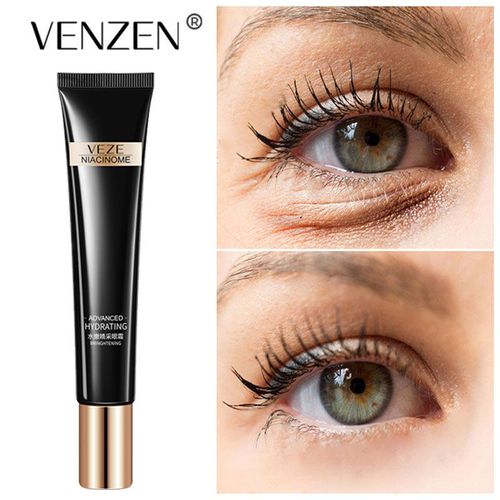Crème Hydratante Pour Les Yeux À La Nicotinamide, Blanchit Les Cernes Sous Les Yeux, Améliore Les Poches Sous Les Yeux, Acide Hyaluronique, Sérum Pour Les Yeux, Élimine Les Déformations 