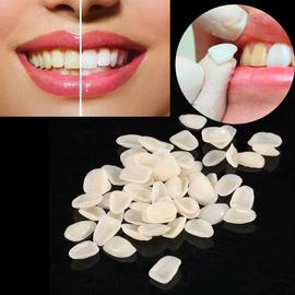 Matériaux de remplissage dentaire Kit composite de polymérisation