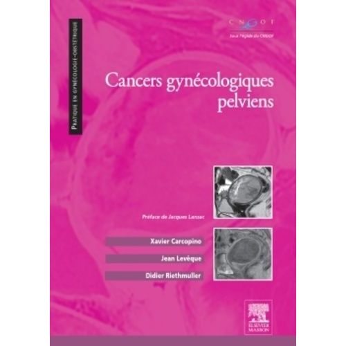 Cancers Gynécologiques Pelviens