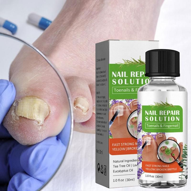 Solution Pour Les Ongles Des Pieds, Solution Pour Les Ongles... - 4