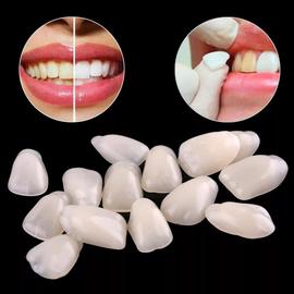 Couronne temporaire Résine ultra mince Blanchiment des dents Facettes  dentaires antérieures Prothèse dentaire Ombre dentaire Souriant
