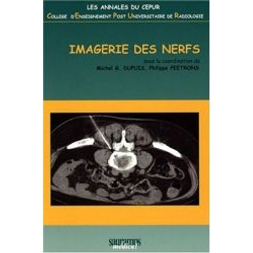 Imagerie Des Nerfs