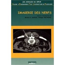 Imagerie Des Nerfs