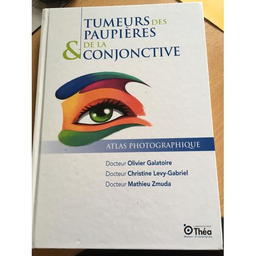 Tumeurs Des Paupieres Et De La Conjonctive