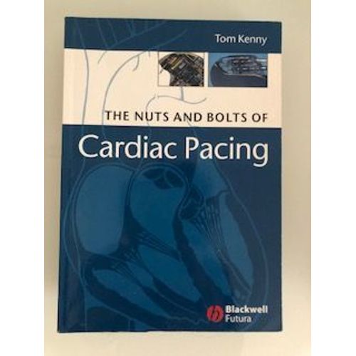 The Nuts And Bolts Of Cardiac Pacing
