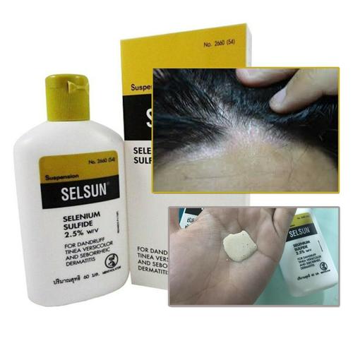 Shampooing Antipelliculaire Selsun Sulfure 2,5% Dermatite Fongique 120 Ml | Anti-Pellicule | Anti-Chute Des Cheveux 