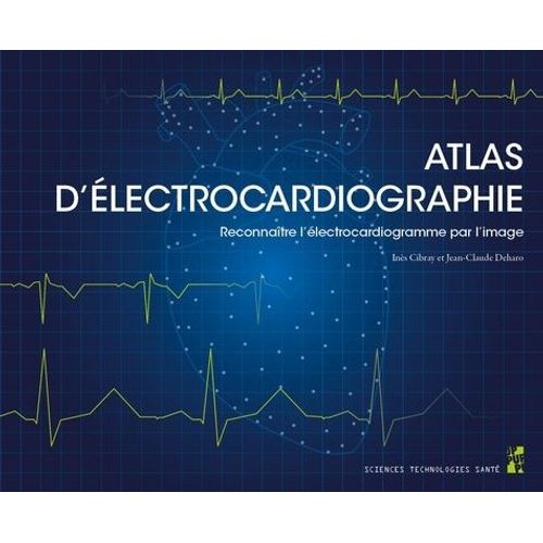 Atlas D?Électrocardiographie - Reconnaître L?Électrocardiogramme Par L?Image