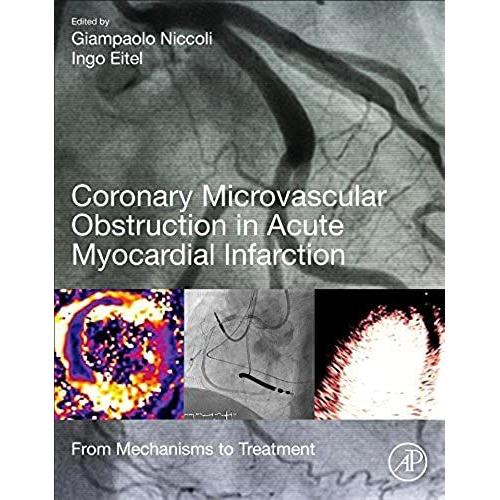 Coronary Microvascular Obstruction In Acute Myocardial Infarction: From Mechanisms To Treatment