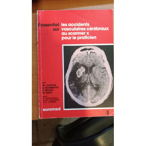 L'essentiel Sur Les Accidents Vasculaires Cérébraux Au Scanner X Pour Le Praticien Par Docteur Philippe Castan