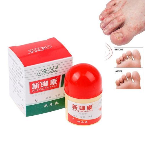 Crème Antibactérienne Pour Les Pieds, Crème Pour Les Pieds, Gommage Des Peaux Mortes Et Des Démangeaisons, Élimine Les Ampoules 