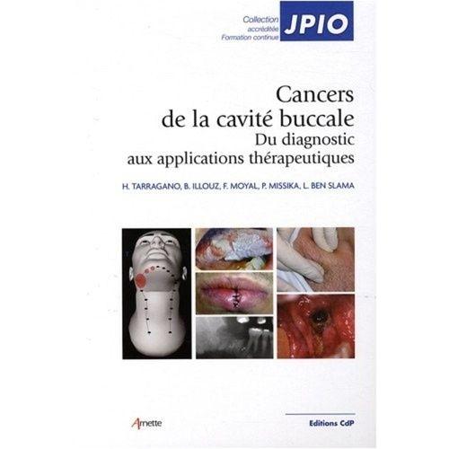 Les Cancers De La Cavité Buccale - Du Diagnostic Aux Applications Thérapeutiques