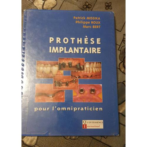 Prothèse Implantaire Pour L'omnipraticien, Patrick Missika, Philippe Roux, Marc Bert.