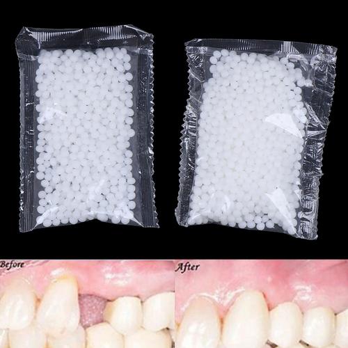 Colle de Réparation Dentaire à Base de Résine Naturelle, pour Fausses Dents,  Outil de Blanchiment des Dents, Fournitures, 50g - AliExpress