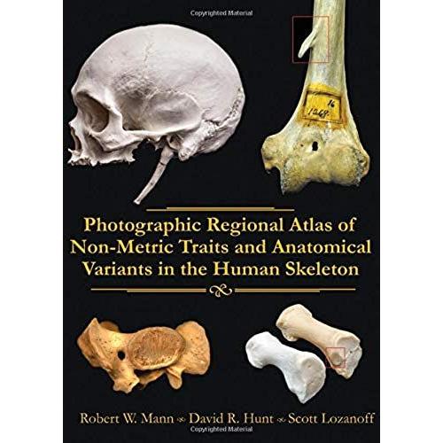 Photographic Regional Atlas Of Non-Metric Traits And Anatomical Variants In The Human Skeleton