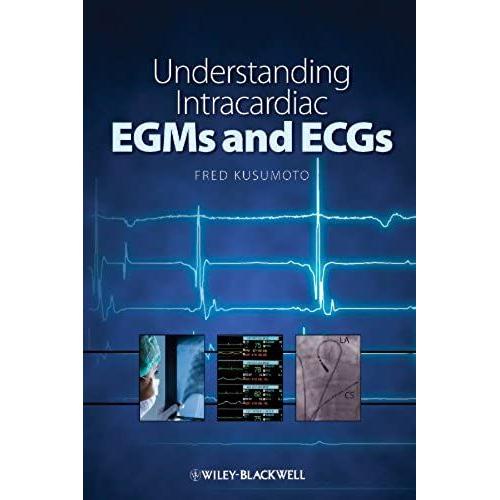 Understanding Intracardiac Egms And Ecgs