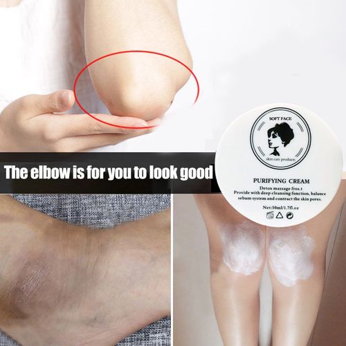 70ml - Crème Blanchissante Anti Acanthose Nigricans, Élimine La Mélanine, Les Ati Elles, Les Coudes, Les Soins Privés Du Corps, Les Fesses Noires, L'élimination Des Impressions Assise