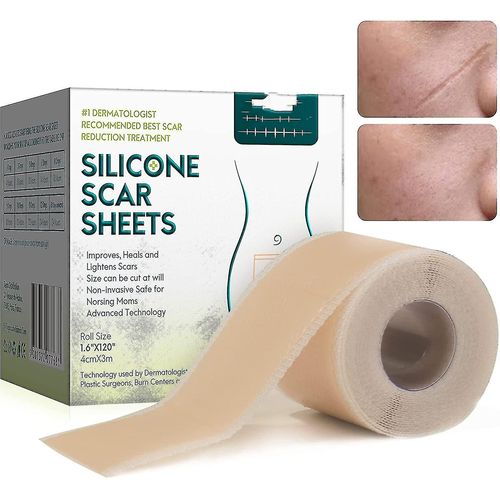 Plâtres En Silicone Pour Cicatrices, Films Cicatriciels En Silicone Pour Chirurgies, Césarienne, Chéloïdes, Brûlures, Ruban Cicatriciel En Silicone-4cm * 3m