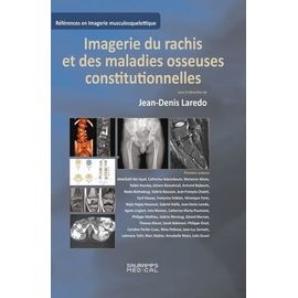 Imagerie Du Rachis Et Des Maladies Osseuses Constitutionnelles - Rachis De L'adulte Et Maladies Osseuses De L'enfant Vues À L'âge Adulte