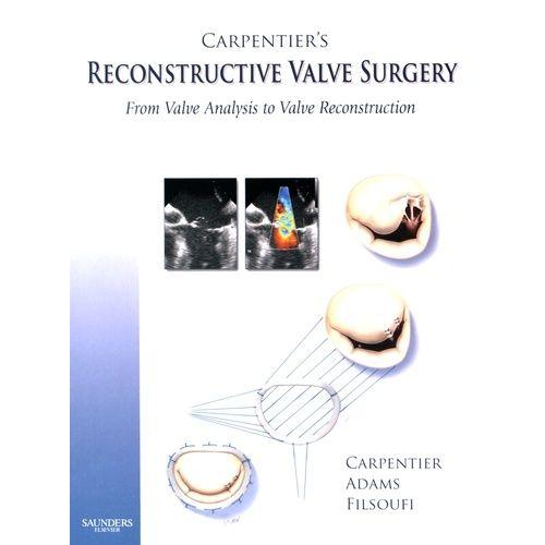 Carpentier's Reconstructive Valve Surgery - From Valve Analysis To Valve Reconstruction