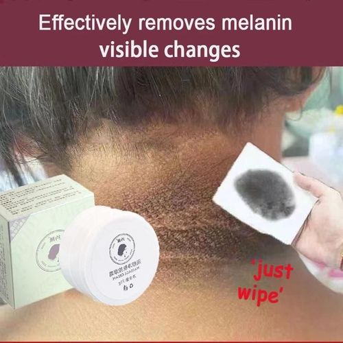 70g - Crème Blanchissante Anti-Acanthose Nigricans, Élimine La Mélanine, Élimine Les Ati Elles, Les Coudes, Soins Privés Du Corps, Les Fesses Noires, Les Impressions Assise, 70g