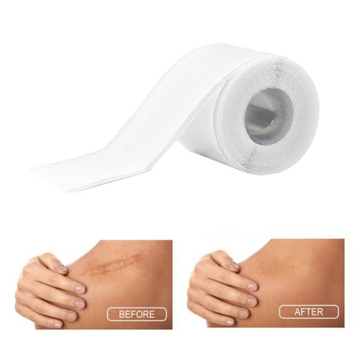 Feuilles De Cicatrices Professionnelles En Silicone, Réutilisables, Pour Réduire Les Rougeurs, Les Démangeaisons, Rouleau De Ruban Adhésif Pour Les Brûlures Chéloïdes 