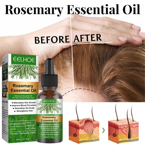 Sérum De Croissance Capillaire Au Romarin, Produits Anti-Perte De Cheveux, Huile Amincissante, Soins Crépus, Dommages Rapides, Réparation Essentielle De La Repousse Des Cheveux Sca S4y6 