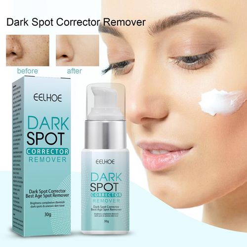 Dissolvant De Taches Foncées, Correcteur De Taches De Rousseur, Émulsion Blanchissante, Hydratante, Réparation Anti-Âge, Soins De La Peau 