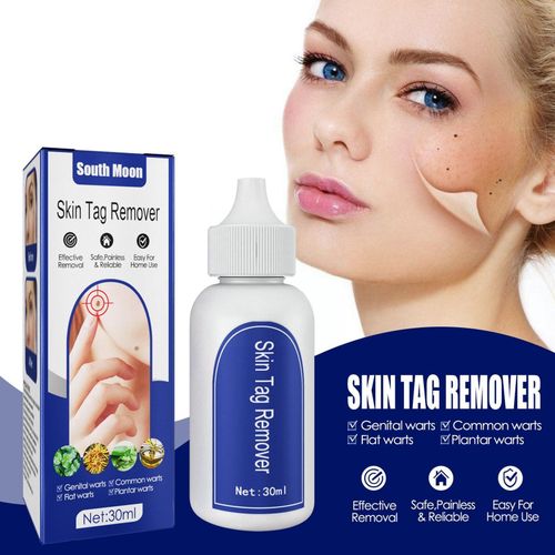 Dissolvant De Verrues Génitales, Dissolvant De Peau, Traitement De Verrues Génit, Outil Naturel D'élimination Instantanée, Grain De Maïs Bactériostatique Et Papillome Liquide De Réparation Des Pieds E 