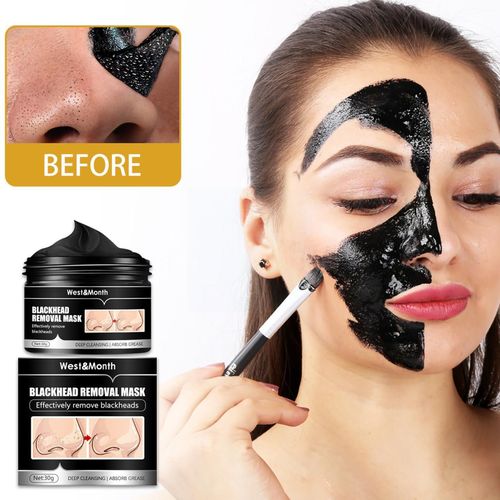 Dissolvant De Points Noirs Pour Le Visage, 30g, Contrôle De L'huile, Nez, Acné, Nettoyage De La Peau, Hydratant En Profondeur, Cosmétiques, Beauté F1e6 