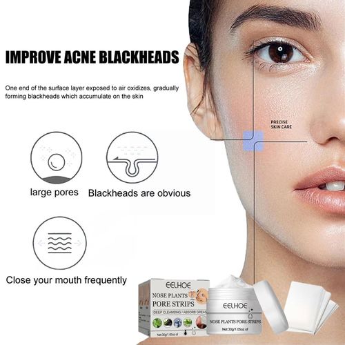 Dissolvant De Points Noirs Pour Le Nez, 30g, Soins Du Visage Pour Femmes, Bandes, Traitement Pelé, Acné, Boue, Nettoyage, O8u0 