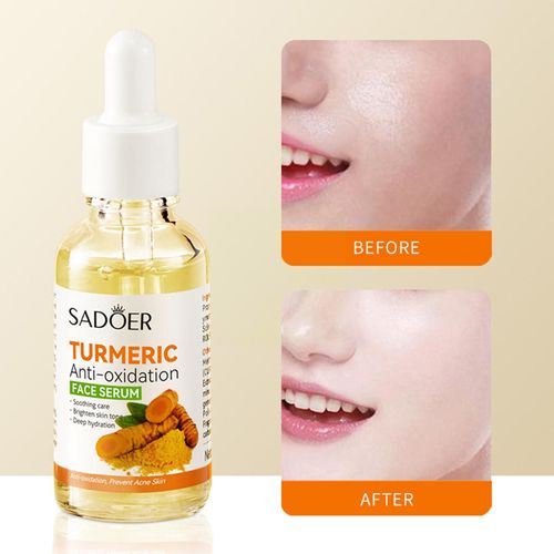 Sérum Turmerique Pour Le Visage, 30ml, Blanchissant, Dissolvant De Taches Foncées, Pour La Peau, Cicatrice, Soins De L'acné, Correcteur Lumineux, Améliore La Rugosité De La Peau, C5w1 