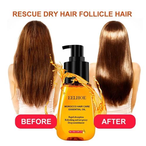 Produit Anti-Perte De Cheveux Marocain, Essence Essentielle Pour Soins Capillaires, Facile À Transporter, Huile De Soins, X5b8 