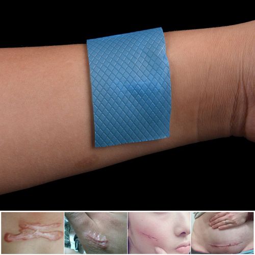 Patch De Gel De Silicone Pour Césarienne, Élimination Des Cicatrices De La Peau Hypertrophiques, Chéloïdes, Thérapie, Traitement Des Cicatrices, 3.5x7cm 