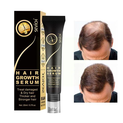Ensemble De Rouleaux De Sérum Pour La Croissance Des Cheveux, Biotine, Produits Amincissants, Traitement Capillaire, Huile De Soins Secs, Endommagée, O4f6 