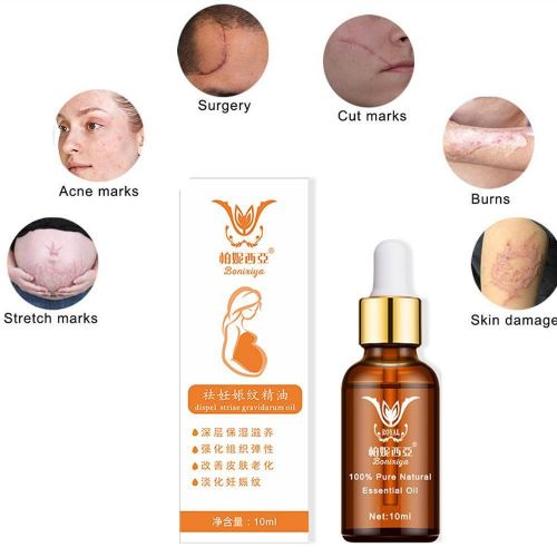 Huile Essentielle Dissolvant De Vergetures S0g1, Élimine Les Vergetures De Grossesse, Traitement Raffermissant, Réparation Anti Cicatrices De La Peau De Maternité 