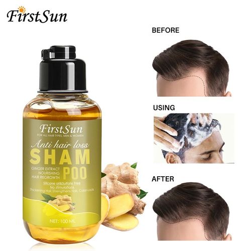 Shampooing À L'extrait De Gingembre Naturel, 1 Pièce, 100ml, Huile Essentielle Pour La Croissance Des Cheveux, Traitement Efficace Contre La Perte De Cheveux, Tslm1 