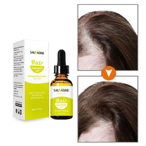 Soins Capillaires Pour Hommes Et Femmes, Traitement Pour Prévenir La Perte De Cheveux, Huile Essentielle, Répare Les Dommages, Restauration, Huile Douce 