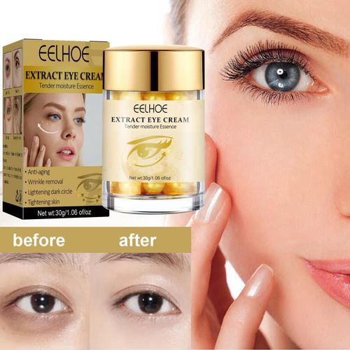 Crème Réparatrice Pour Les Yeux, Or 30g, Hydratante, Anti-Boursouflure, Foncée, Élimine Les Rides, Soins Anti-Cernes, Anti-Âge, P4b0 