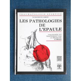 Les Pathologies De L Paule Diagnostic Et Traitement Par La M Thode