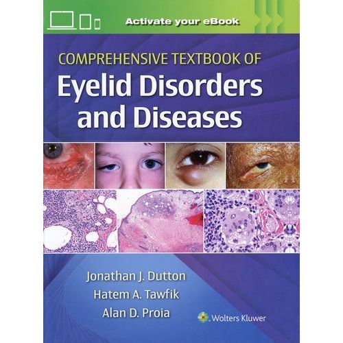 Comprehensive Textbook Of Eyelid Disorders And Diseases