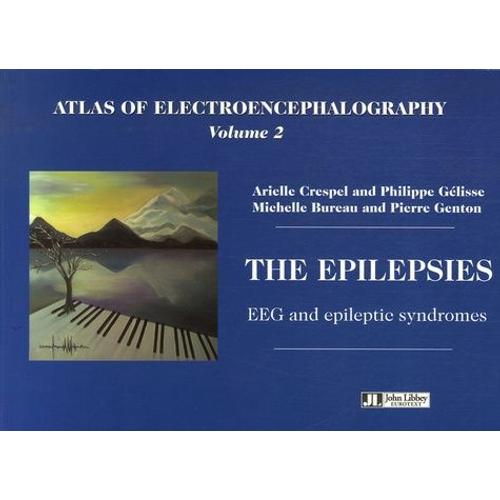 Atlas Of Electroencephalography - Volume 2, The Epilepsies, Eeg And Epileptic Syndromes