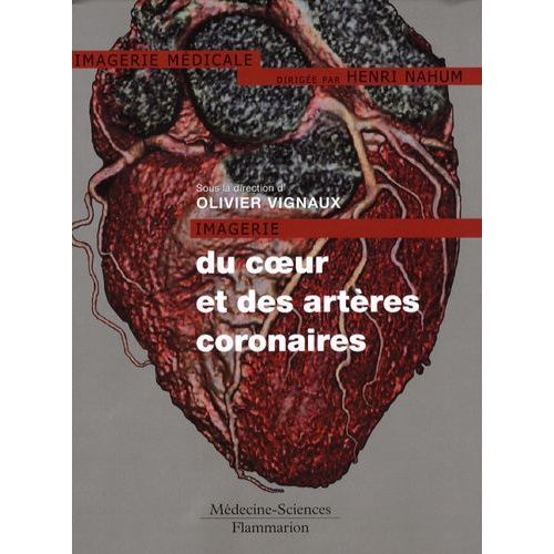 Imagerie Du Coeur Et Des Artères Coronaires