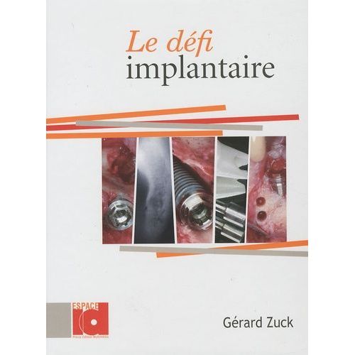 Le Défi Implantaire