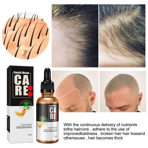 L'huile Essentielle De Cheveux Nourrit La Racine Des Cheveux Cuir Chevelu Croissance Rapide Essence De Cheveux Soin Des Cheveux Anti-Chute Solution Nutritive Pour Le Soin Des Cheveux 