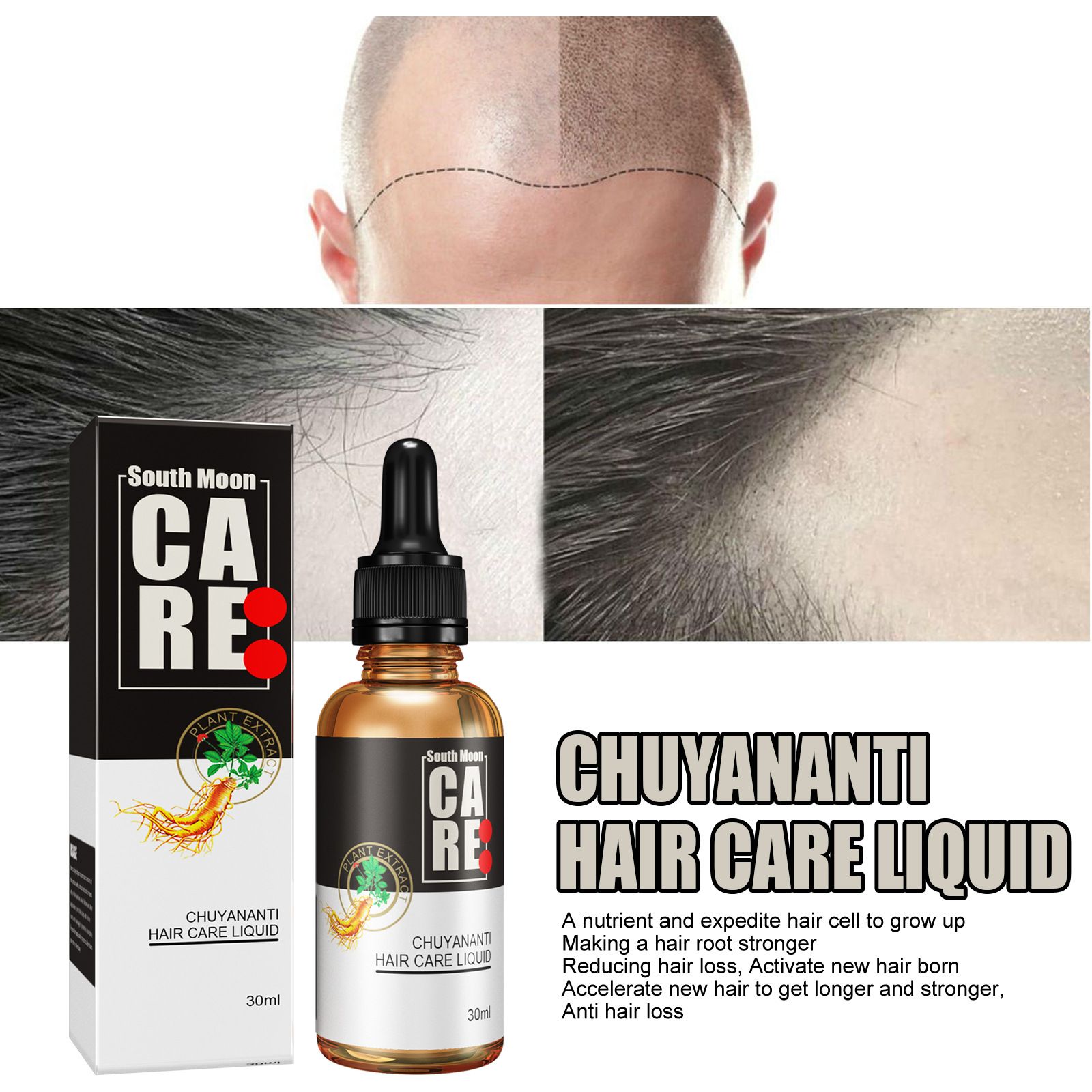 Huile Essentielle De Cheveux Soin Des Cheveux Solution Nutri... - 3