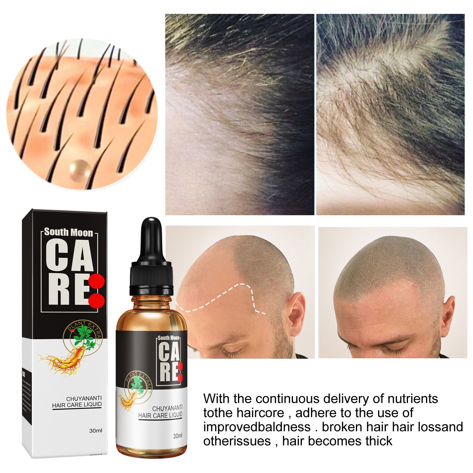 Huile Essentielle De Cheveux Soin Des Cheveux Solution Nutri... - 4
