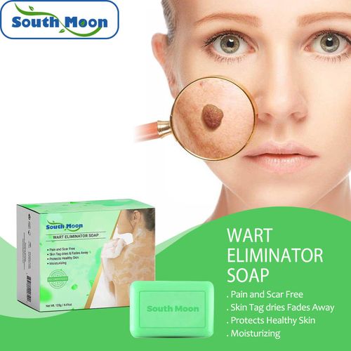 Savon Anti-Verrues Visage Cou Corps Soin Nettoyant Pour La Peau Gram Savon Anti-Verrues 