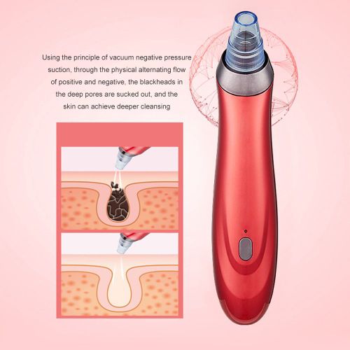 Nettoyeur Électrique De Pores Du Visage, Outil De Nettoyage De Peau En Diamant, Aiguilles, Dissolvant D'acné Et De Taches Noires, Aspiration 