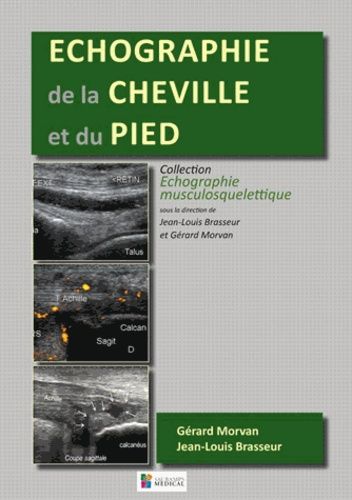 Echographie De La Cheville Et Du Pied Sant M decine Rakuten